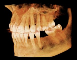Office CT Scans