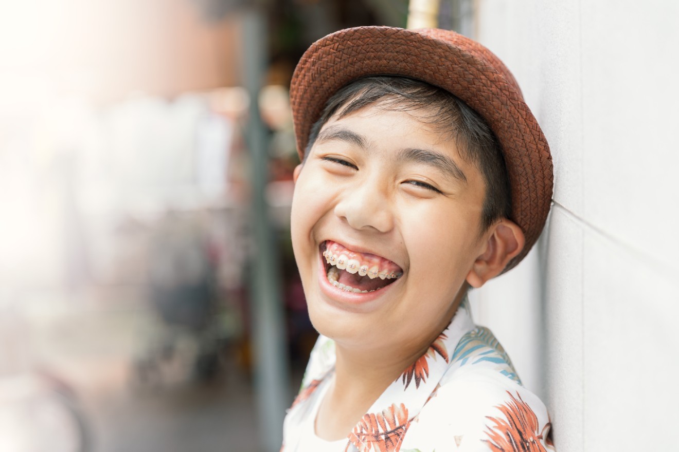 Braces for All Ages