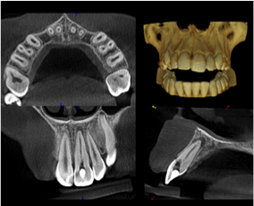 Cone Beam CT in Cumming, GA